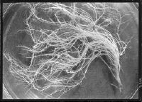 Nodule bacteria on root of pea